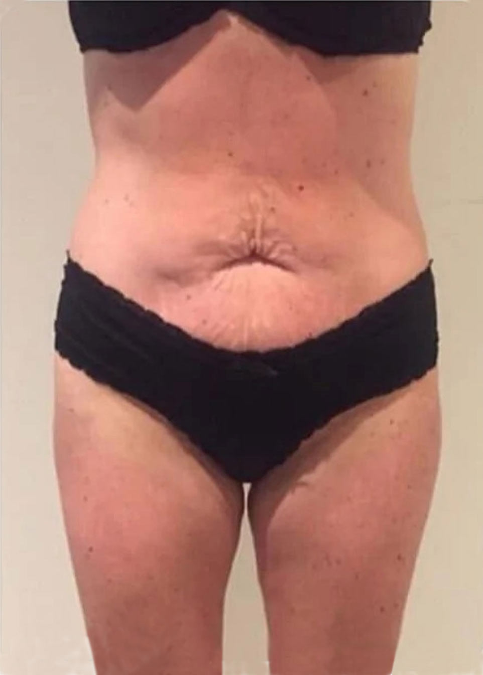 Po